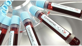 Gün gün, dakika dakika Türkiye’de Covid-19